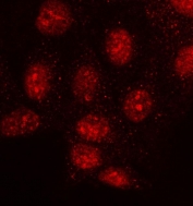 Immunofluorescent staining of FFPE human HeLa cells with MMS19 antibody (red). HIER: steam section in pH6 citrate buffer for 20 min.