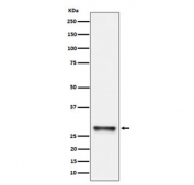 Western blot testing of human K562 cell lysate with PNMT antibody. Predicted molecular weight ~31 kDa.