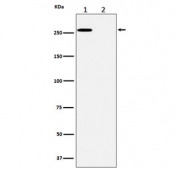 Western blot testing of lysate from A431 cells 1) untreated and 2) treated with lambda phosphatase, with Phospho-ACACA antibody.