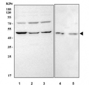 Western blot testing of 1) human SiHa, 2) human HepG2, 3) human RT4, 4) rat liver and 5) mouse liver tissue lysate with MGAT2 antibody. Predicted molecular weight ~52 kDa.