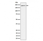 Western blot testing of human 293T cell lysate with MEKK4 antibody. Predicted molecular weight: 177-182 kDa (two isoforms).