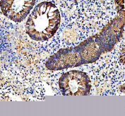 IHC staining of FFPE human appendix tissue with Keratin 19 antibody. HIER: boil tissue sections in pH8 EDTA for 20 min and allow to cool before testing.
