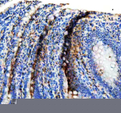 IHC staining of FFPE rat small intestine tissue with Keratin 19 antibody. HIER: boil tissue sections in pH8 EDTA for 20 min and allow to cool before testing.