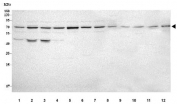Western blot testing of 1) human Jurkat, 2) human HepG2, 3) human K562, 4) human ThP-1, 5) human PC-3, 6) human A549, 7) human HeLa, 8) human SH-SY5Y, 9) rat kidney, 10) rat H9C2, 11) mouse kidney and 12) mouse HEPA1/6 cell lysate with NUDT6 antibody. Expected molecular weight ~72 kDa (homodimer).