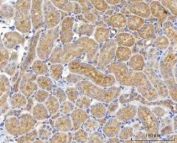 IHC staining of FFPE mouse kidney tissue with NUDT6 antibody. HIER: boil tissue sections in pH8 EDTA for 20 min and allow to cool before testing.