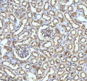 IHC staining of FFPE rat kidney tissue with GCLM antibody. HIER: boil tissue sections in pH8 EDTA for 20 min and allow to cool before testing.