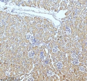 IHC staining of FFPE mouse kidney tissue with GCLM antibody. HIER: boil tissue sections in pH8 EDTA for 20 min and allow to cool before testing.