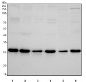 Western blot testing of 1) human HeLa, 2) human A549, 3) human Jurkat, 4) human K562, 5) rat liver and 6) mouse liver tissue lysate with GCLM antibody. Predicted molecular weight: 28-31 kDa (two isoforms).