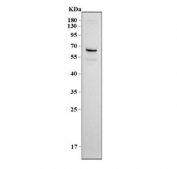 Western blot testing of human SH-SY5Y cell lysate with NPFF2 Receptor antibody. Predicted molecular weight ~60 kDa, ~49 kDa and ~15 kDa (multiple isoforms).
