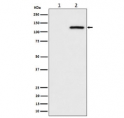 Western blot testing of lysate from human HeLa cells 1) untreated and 2) pervanadate-treated, with Phospho-CBL antibody.