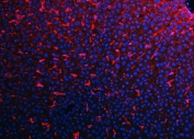 Immunofluorescent staining of FFPE rat liver tissue with Adgre1 antibody (red) and DAPI nuclear stain (blue). HIER: steam section in pH8 EDTA buffer for 20 min.