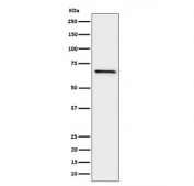 Western blot testing of human Ramos cell lysate with GRK6 antibody. Predicted molecular weight ~66 kDa.