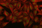 Immunofluorescent staining of FFPE human U-2 OS cells with MED26 antibody (green) and Beta Tubulin mAb (red). HIER: steam section in pH6 citrate buffer for 20 min.