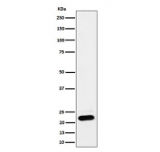 Western blot testing of human HEK293 cell lysate with NDUFB9 antibody. Predicted molecular weight ~22 kDa.