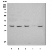 Western blot testing of 1) human 293T, 2) human ThP-1, 3) human K532, 4) rat testis and 5) mouse testis tissue lysate with NUP42 antibody. Predicted molecular weight ~36 kDa.