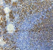 IHC staining of FFPE human tonsil tissue with NRMT antibody. HIER: boil tissue sections in pH8 EDTA for 20 min and allow to cool before testing.