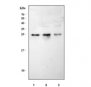 Western blot testing of human 1) 293T, 2) HeLa and 3) A549 cell lysate with NRMT antibody. Predicted molecular weight ~25 kDa.