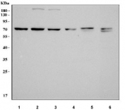 Western blot testing of 1) human HepG2, 2) human RT4, 3) human A431, 4) human Caco-2, 5) rat kidney and 6) mouse kidney tissue lysate with MGAT4B antibody. Predicted molecular weight ~63 kDa but may be observed at higher molecular weights due to glycosylation.
