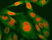 Immunofluorescent staining of FFPE human HeLa cells with MED29 antibody (red) and Beta Tubulin mAb (green). HIER: steam section in pH6 citrate buffer for 20 min.