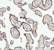 IHC staining of FFPE human placental tissue with NUBPL antibody. HIER: boil tissue sections in pH8 EDTA for 20 min and allow to cool before testing.