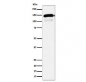 Western blot testing of human HepG2 cell lysate with Phospholipase C-beta-1 antibody. Predicted molecular weight ~139 kDa.