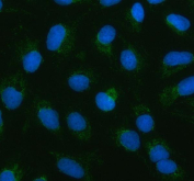Immunofluorescent staining of FFPE human U-2 OS cells with MARS2 antibody (green) and DAPI nuclear stain (blue). HIER: steam section in pH6 citrate buffer for 20 min.