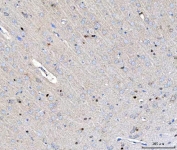 IHC staining of FFPE rat brain tissue with NUP54 antibody. HIER: boil tissue sections in pH8 EDTA for 20 min and allow to cool before testing.