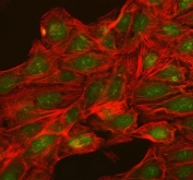 Immunofluorescent staining of FFPE human U-2 OS cells with NUP54 antibody (green) and phalloidin (red). HIER: steam section in pH6 citrate buffer for 20 min.