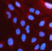 Immunofluorescent staining of FFPE human U-2 OS cells with PSTPIP2 antibody (red) and DAPI nuclear stain (blue). HIER: steam section in pH6 citrate buffer for 20 min.