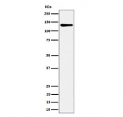 Western blot testing of human HeLa cell lysate with MCM2 antibody. Commonly observed at 100-130 kDa.
