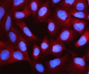 Immunofluorescent staining of FFPE human U-2 OS cells with NUDCD3 antibody (red) and DAPI nuclear stain (blue). HIER: steam section in pH6 citrate buffer for 20 min.