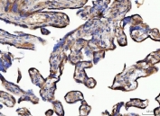 IHC staining of FFPE human placental tissue with NUDCD3 antibody. HIER: boil tissue sections in pH8 EDTA for 20 min and allow to cool before testing.