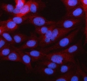 Immunofluorescent staining of FFPE human HeLa cells with MARCH2 antibody (red) and DAPI nuclear stain (blue). HIER: steam section in pH6 citrate buffer for 20 min.