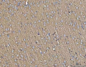 IHC staining of FFPE rat brain tissue with MFAP3 antibody. HIER: boil tissue sections in pH8 EDTA for 20 min and allow to cool before testing.