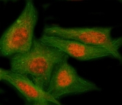 Immunofluorescent staining of FFPE human HeLa cells with NAP1L5 antibody (red) and Beta Tubulin mAb (green). HIER: steam section in pH6 citrate buffer for 20 min.