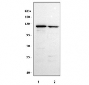 Western blot testing of human 1) A431 and 2) A549 cell lysate with MYH16 antibody. Predicted molecular weight ~128 kDa.