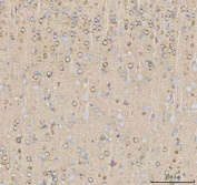 IHC staining of FFPE rat brain tissue with NPTXR antibody. HIER: boil tissue sections in pH8 EDTA for 20 min and allow to cool before testing.