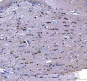 IHC staining of FFPE rat brain tissue with MAP6D1 antibody. HIER: boil tissue sections in pH8 EDTA for 20 min and allow to cool before testing.