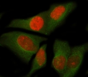 Immunofluorescent staining of FFPE human HeLa cells with NOC4L antibody (red) and Beta Tubulin mAb (green). HIER: steam section in pH6 citrate buffer for 20 min.