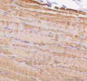 IHC staining of FFPE human skeletal muscle tissue with MYL5 antibody. HIER: boil tissue sections in pH8 EDTA for 20 min and allow to cool before testing.