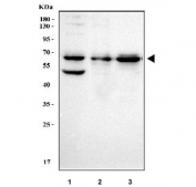 Western blot testing of human 1) MCF7, 2) HeLa and 3) RT4 cell lysate with Ladinin 1 antibody. Predicted molecular weight ~57 kDa.