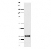 Western blot testing of human HeLa cell lysate with High mobility group protein B3 antibody. Predicted molecular weight ~23 kDa.