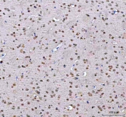 IHC staining of FFPE mouse brain tissue with PSIP1 antibody. HIER: boil tissue sections in pH8 EDTA for 20 min and allow to cool before testing.