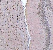 IHC staining of FFPE rat brain tissue with PSIP1 antibody. HIER: boil tissue sections in pH8 EDTA for 20 min and allow to cool before testing.