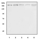 Western blot testing of 1) human K562, 2) human MCF7, 3) rat testis, 4) rat C6 and 5) mouse testis tissue lysate with PCF11 antibody. Predicted molecular weight ~173 kDa.