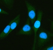 Immunofluorescent staining of FFPE human HeLa cells with ATG7 antibody (green) and DAPI nuclear stain (blue). HIER: steam section in pH6 citrate buffer for 20 min.