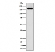 Western blot testing of human A673 cell lysate with ZFYVE9 antibody. Predicted molecular weight ~156 kDa.