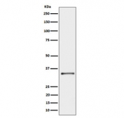 Western blot testing of human A431 cell lysate with Cytochrome b5 reductase 3 antibody. Predicted molecular weight ~34 kDa.