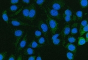 Immunofluorescent staining of FFPE human HeLa cells with Pyruvate Carboxylase antibody (green) and DAPI nuclear stain (blue). HIER: steam section in pH6 citrate buffer for 20 min.