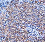 IHC staining of FFPE rat kidney tissue with Pyruvate Carboxylase antibody. HIER: boil tissue sections in pH8 EDTA for 20 min and allow to cool before testing.